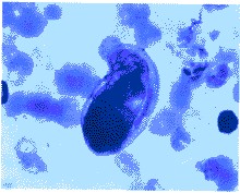 鯉斜管蟲(chóng)