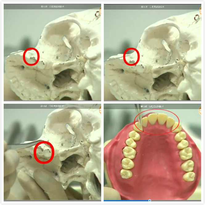 實(shí)操精講圖組 實(shí)操精講圖組