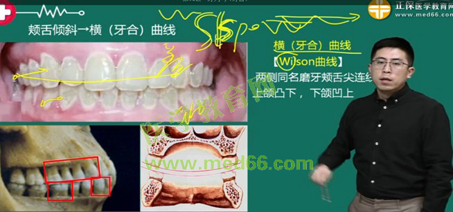 上下頜反橫(牙合)曲線形成的原因是 上下頜反橫(牙合)曲線形成的原因是