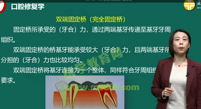 雙端固定橋 雙端固定橋