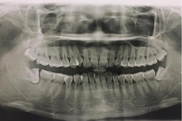 病例分析2 病例分析2