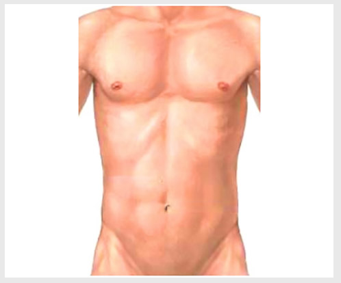 請指出心尖區(qū)內聽診有何異常 請指出心尖區(qū)內聽診有何異常