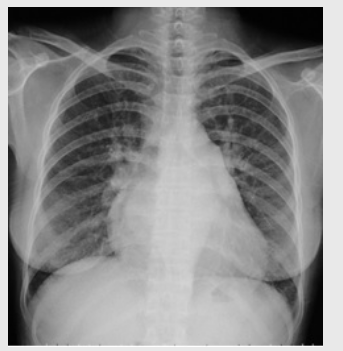 根據下圖請做出正確診斷 根據下圖請做出正確診斷