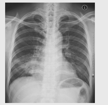 根據下圖請做出正確診斷04 根據下圖請做出正確診斷04