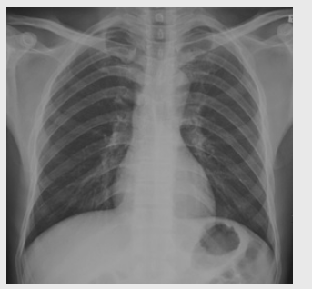 5.根據下圖請做出正確診斷 5.根據下圖請做出正確診斷