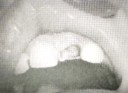 口腔病例分析1 口腔病例分析1