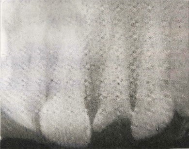 口腔病例分析2 口腔病例分析2