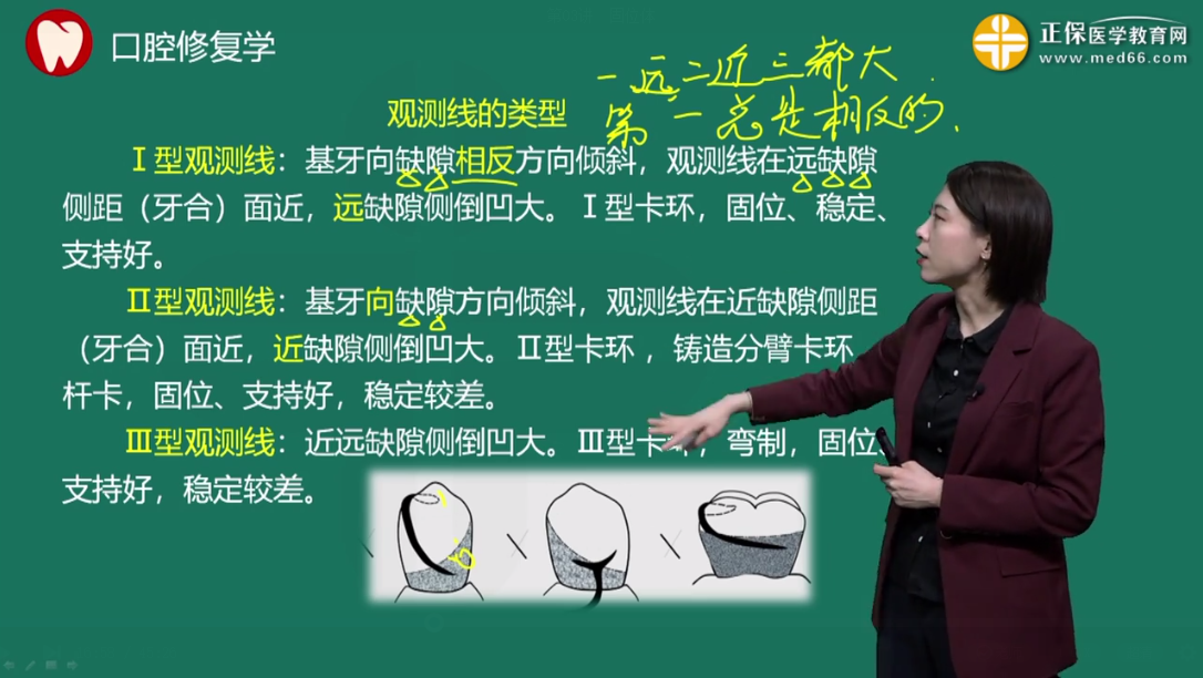 二型觀測(cè)線 二型觀測(cè)線