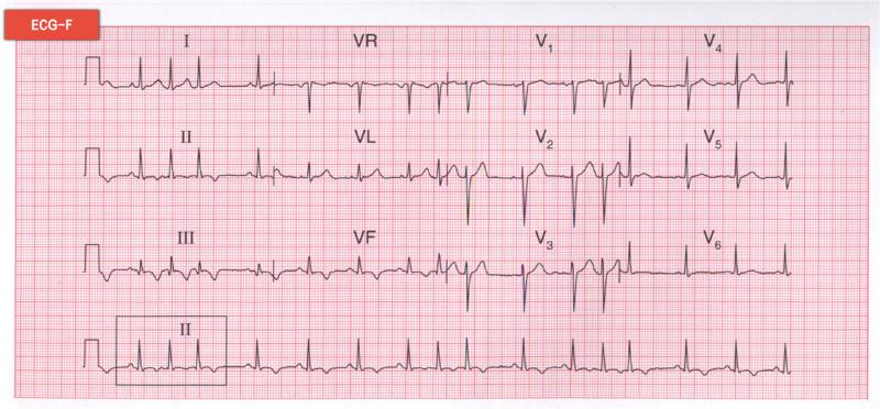 技能第一站卷三6 技能第一站卷三6