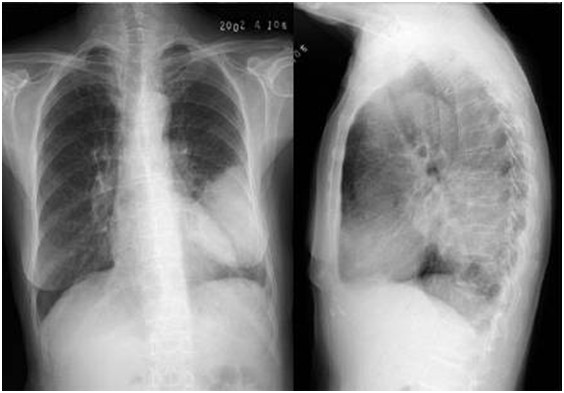 影像診斷 影像診斷