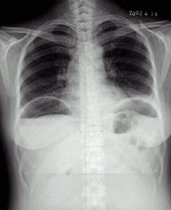 1492426184142-0 1492426184142-0