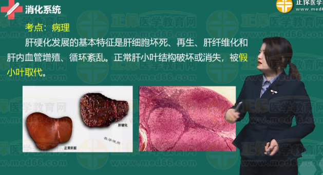 肝硬化病理 肝硬化病理