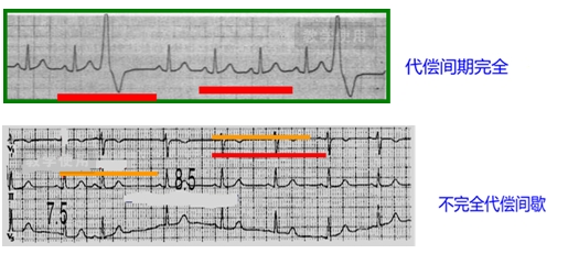代替間歇 代替間歇