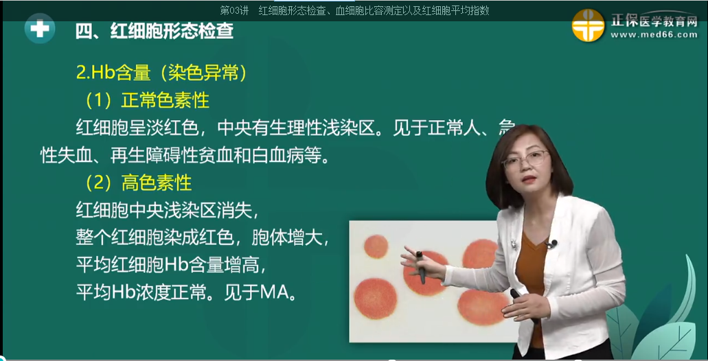 巨幼細(xì)胞性貧血 巨幼細(xì)胞性貧血