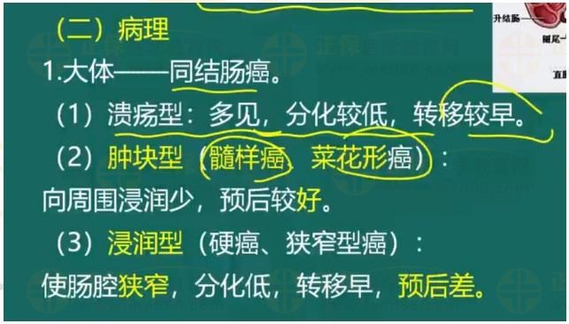 直腸癌病理 直腸癌病理