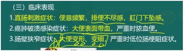 直腸癌臨床表現(xiàn) 直腸癌臨床表現(xiàn)