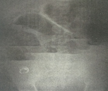 西醫(yī)臨床答辯 西醫(yī)臨床答辯