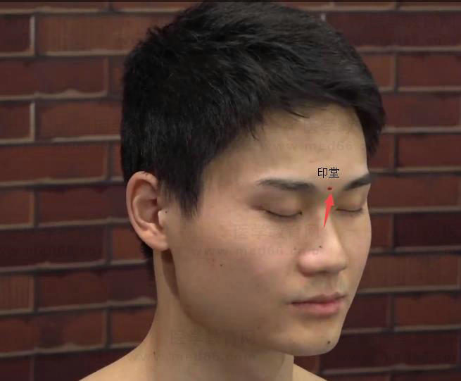 印堂 印堂