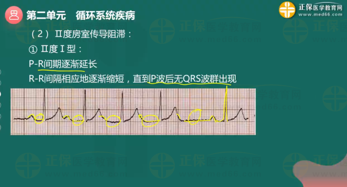 循環(huán)系統(tǒng)疾病2 循環(huán)系統(tǒng)疾病2