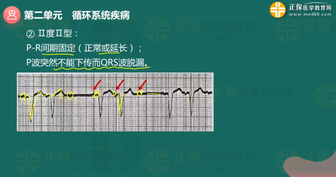 循環(huán)系統(tǒng)疾病3 循環(huán)系統(tǒng)疾病3