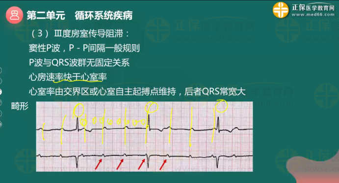 循環(huán)系統(tǒng)疾病4 循環(huán)系統(tǒng)疾病4