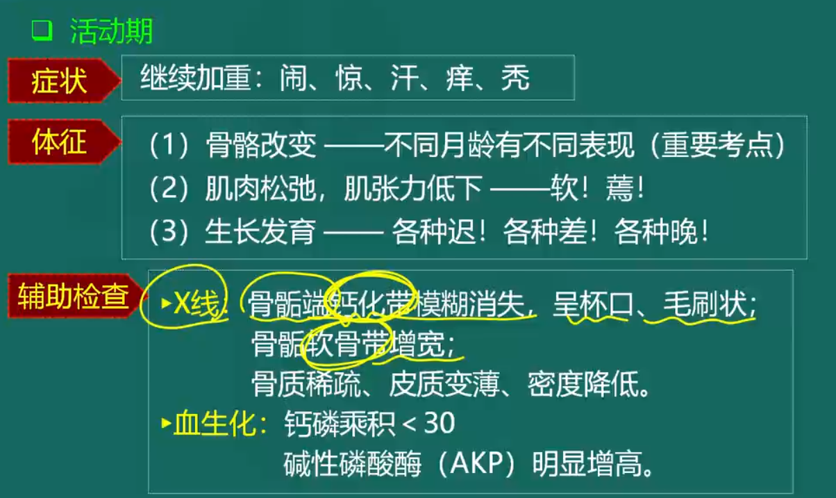 維生素D缺乏性佝僂病-2 維生素D缺乏性佝僂病-2