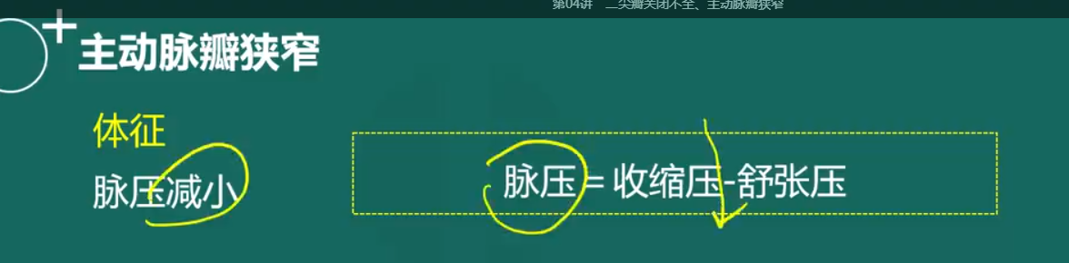 主動脈瓣狹窄-4 主動脈瓣狹窄-4