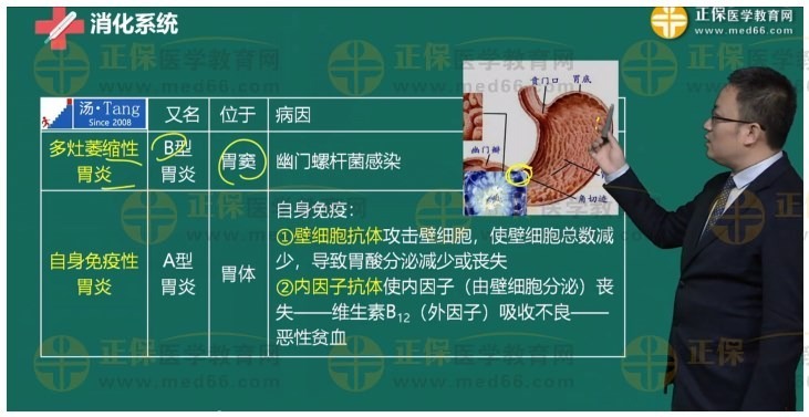 -食管、胃、十二指腸疾病