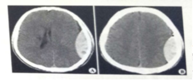 影像學(xué)試題2 影像學(xué)試題2