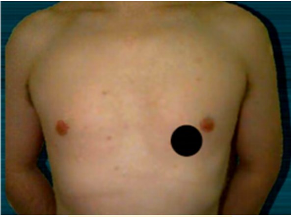 心肺聽診1 心肺聽診1