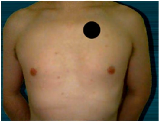 聽診區(qū) 聽診區(qū)